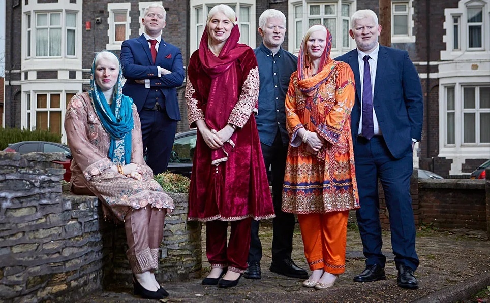 Trai long tu gia dinh co nhieu nguoi con mac benh bach tang nhat hinh anh