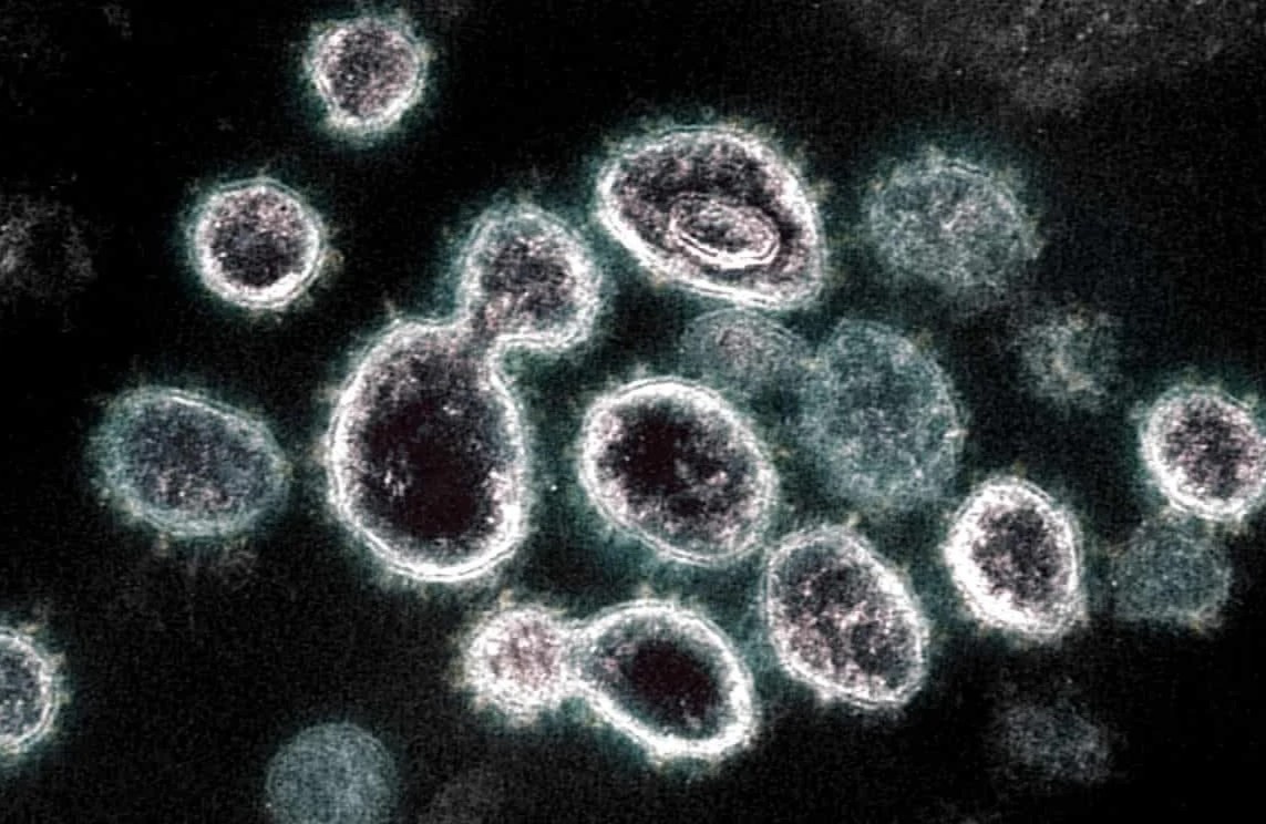 Phat hien moi giup som xac dinh nguoi mac Covid-19 keo dai hinh anh