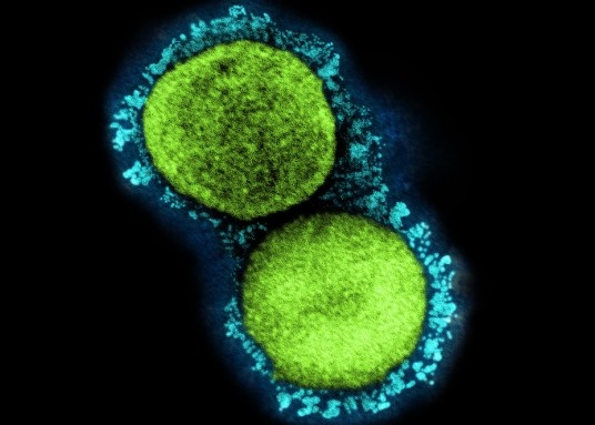 Loai bien chung dang lay lan voi 'toc do bung no' o Trieu Tien hinh anh