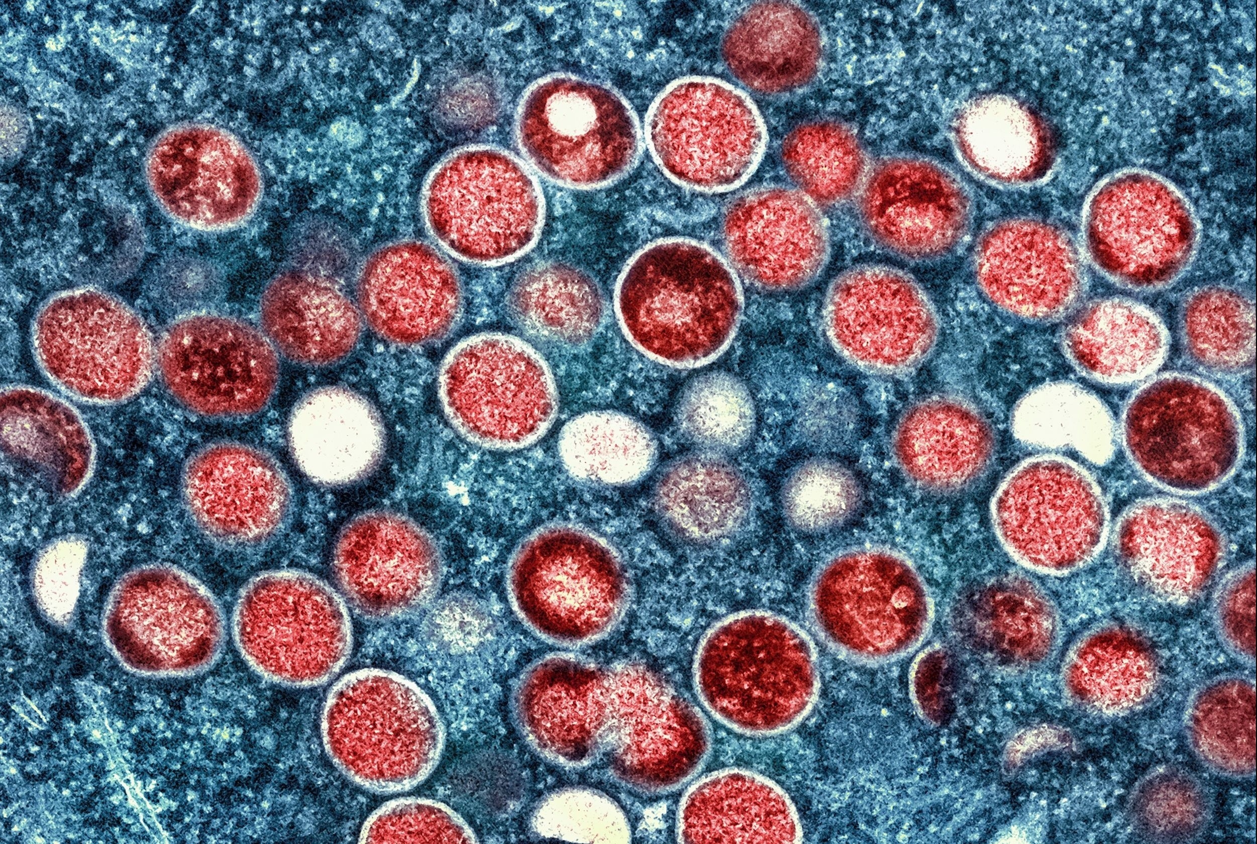 WHO trieu tap cuoc hop khan ve su lay lan cua benh dau mua khi hinh anh