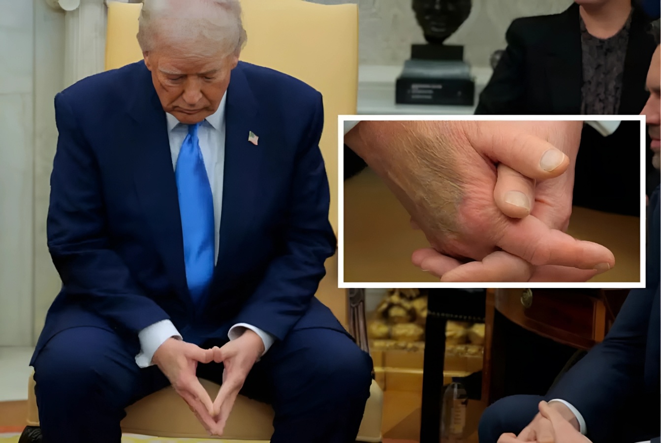 Ban tay cua ong Trump bat ngo thu hut su chu y hinh anh