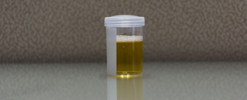 len men trong bang quang,  nuoc tieu chua ethanol,  di tieu ra ruou anh 1