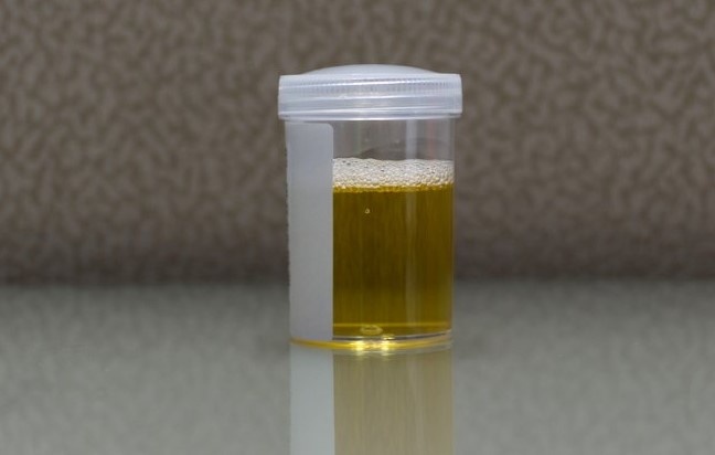 Lan dau  phat hien nguoi tieu ra con hinh anh