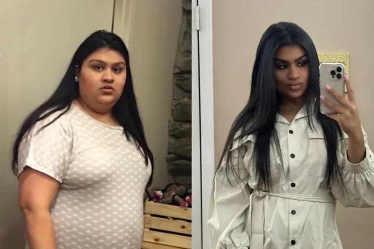 Tranh cai viec co gai My giam 40 kg nho an keo hinh anh