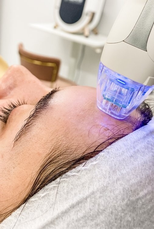 xu huong lam dep anh 18