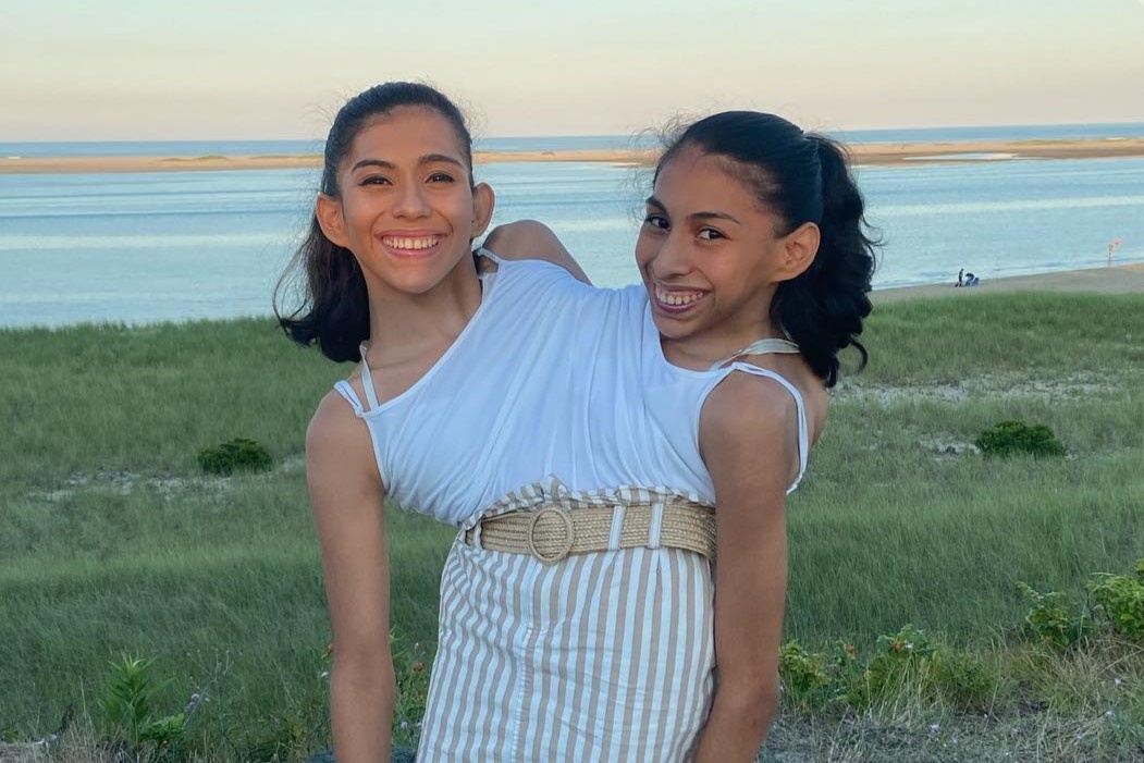 Cap sinh doi dinh lien lam the nao de hen ho hinh anh