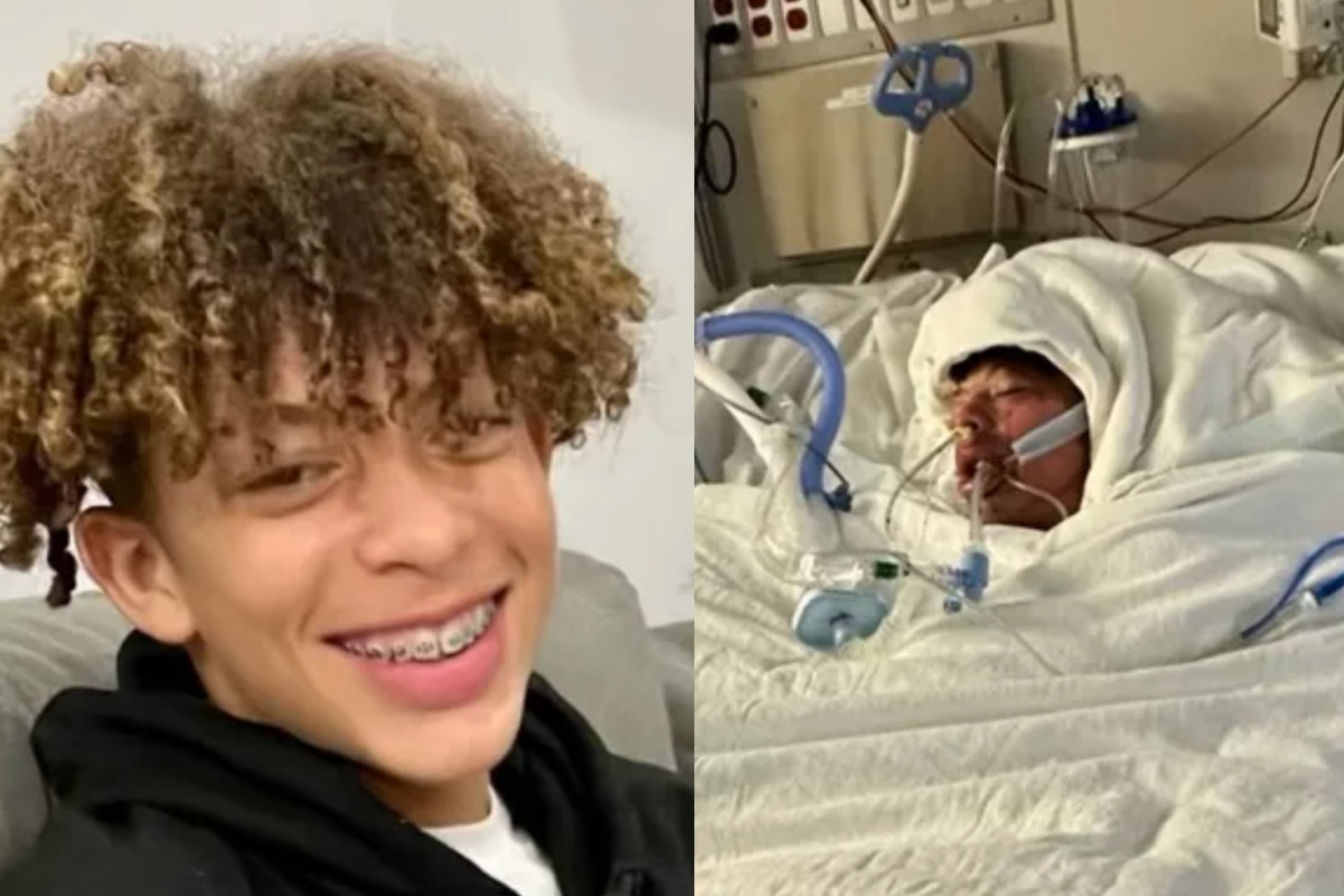 Bi bong gan 80% co the vi thuc hien thu thach tren TikTok hinh anh