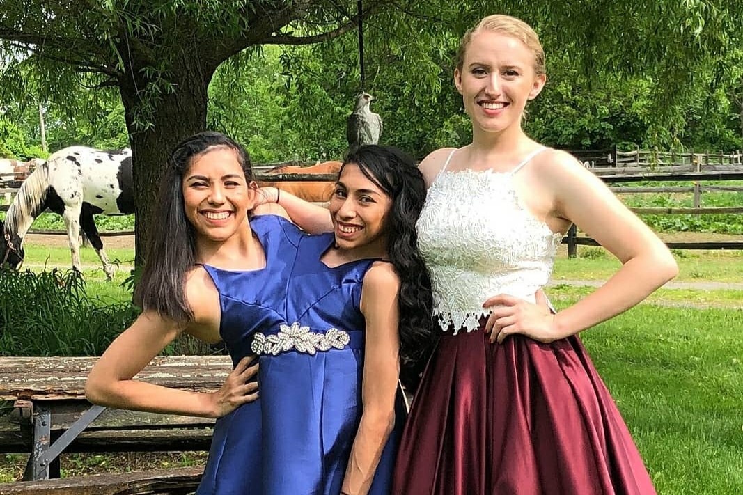 sinh doi dinh lien anh 1