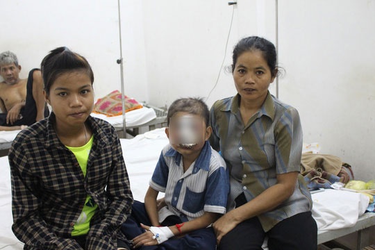 Be trai mat mang vi benh la an mon khuon mat hinh anh