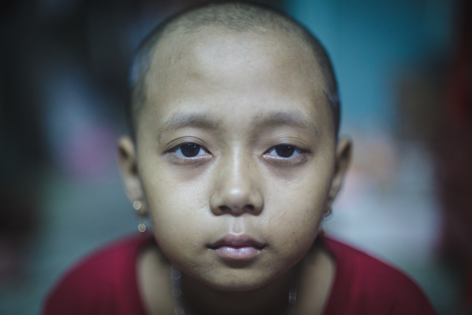 Cuoc chien gianh giat su song cua mot benh nhi ung thu mau hinh anh