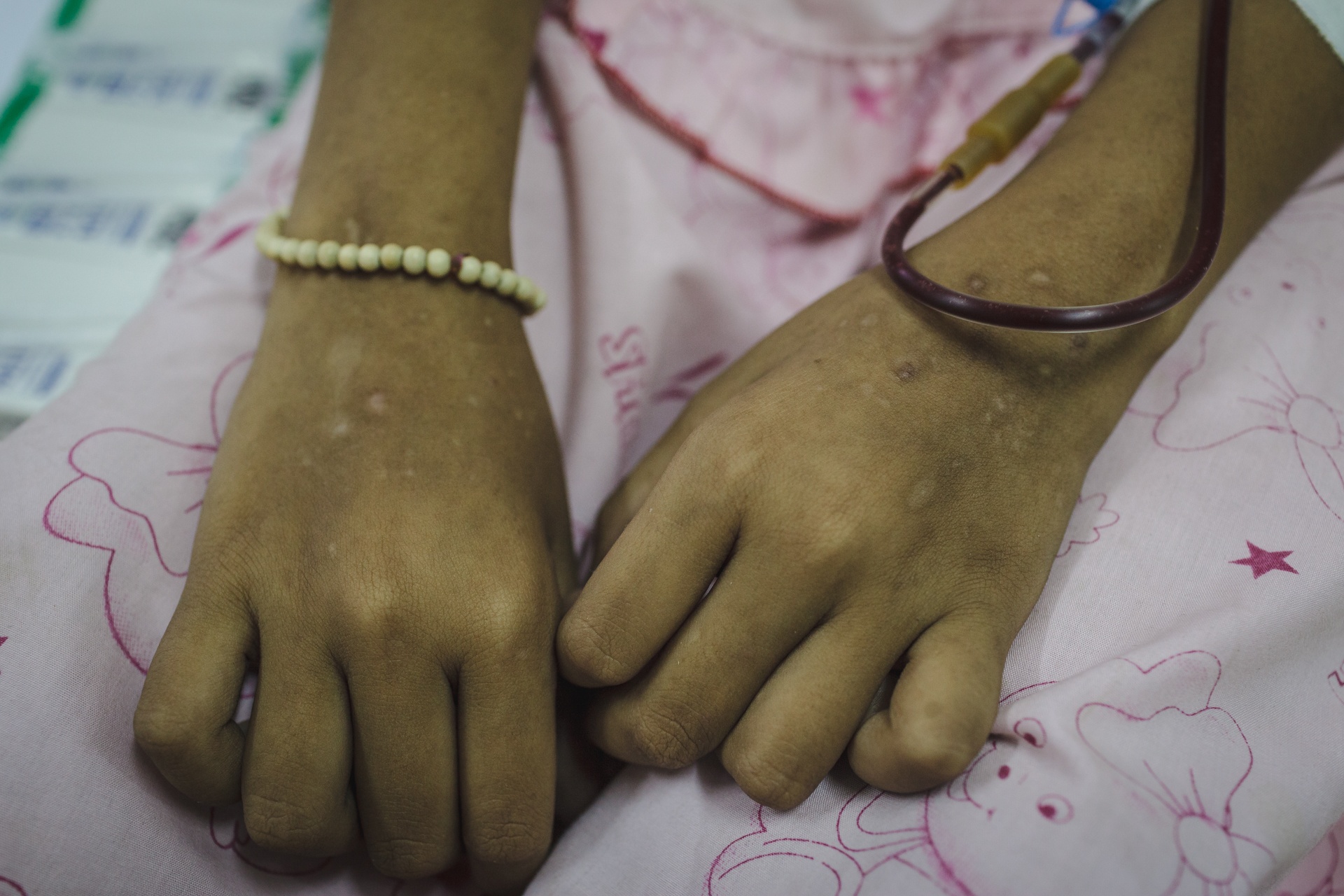 Hanh trinh cua benh nhi ung thu anh 4