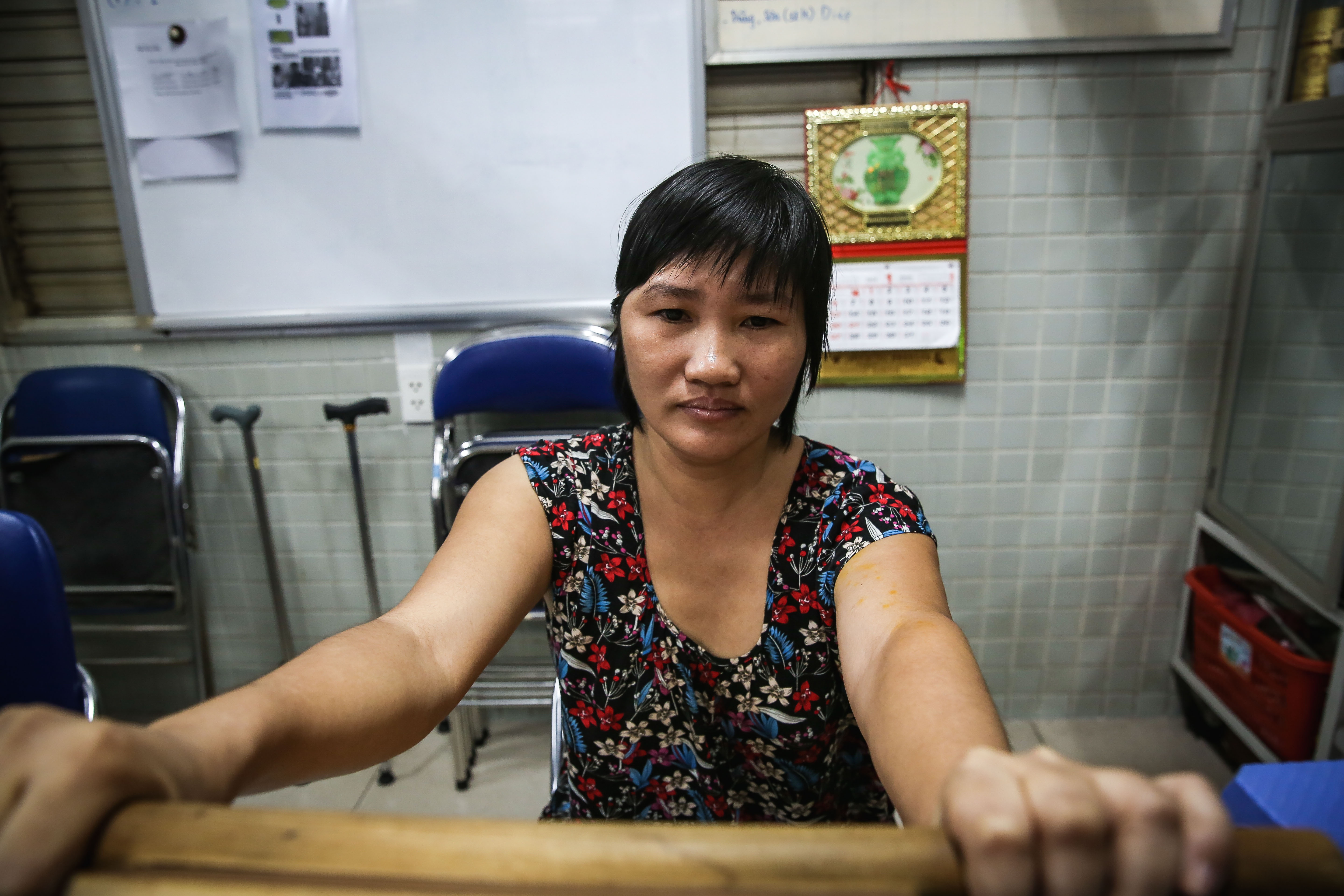 những người đi tìm sự bình thường bằng vật lý trị liệu ảnh 2 nhung nguoi di tim su binh thuong bang vat ly tri lieu anh 2
