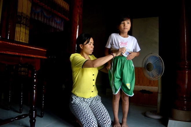 Be gai 8 tuoi bi bo danh nhap vien anh 2