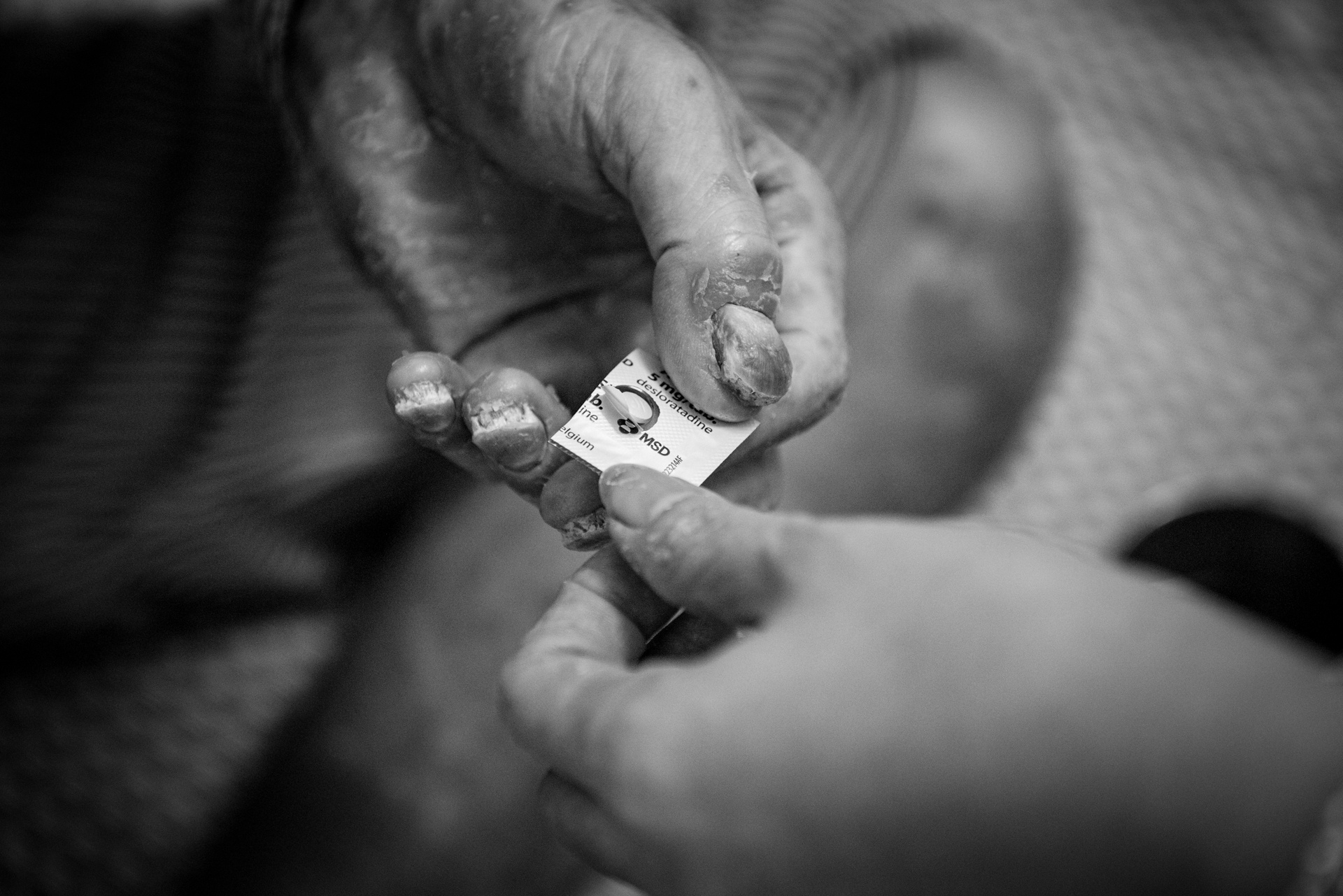 Bệnh nhân vảy nến ảnh 25 Benh nhan vay nen anh 25