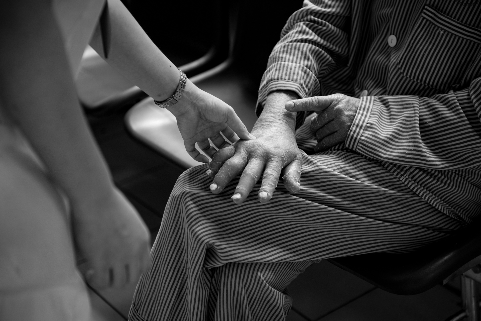 Bệnh nhân vảy nến ảnh 13 Benh nhan vay nen anh 13