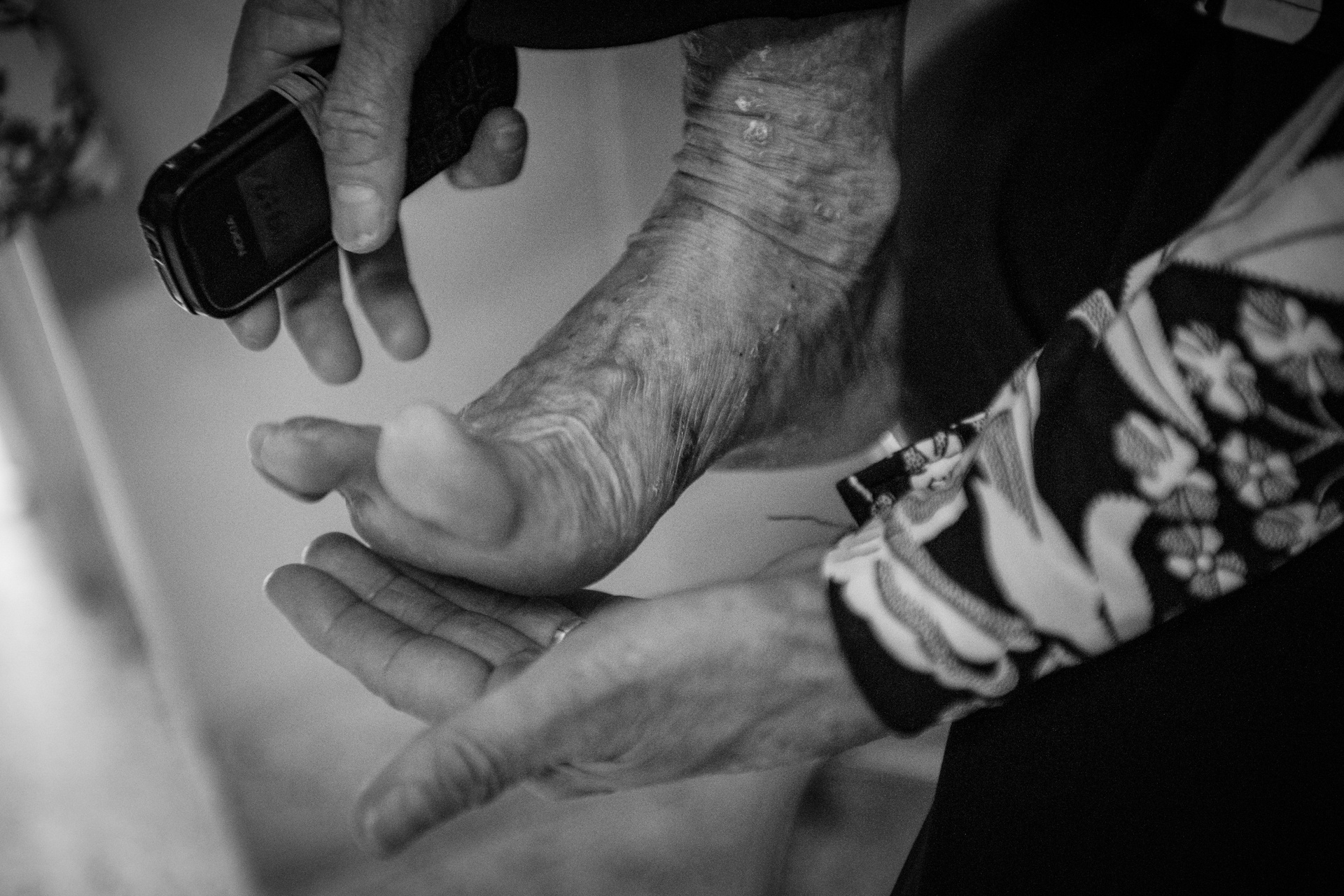 Bệnh nhân vảy nến ảnh 20 Benh nhan vay nen anh 20