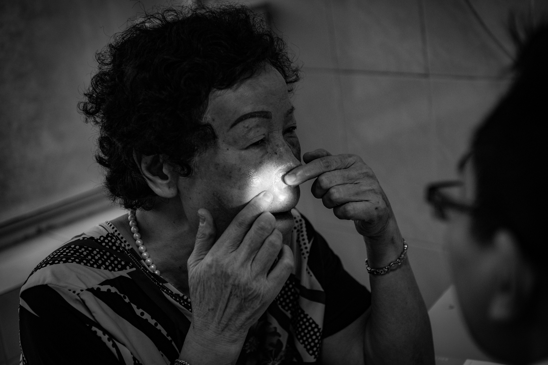 Bệnh nhân vảy nến ảnh 5 Benh nhan vay nen anh 5