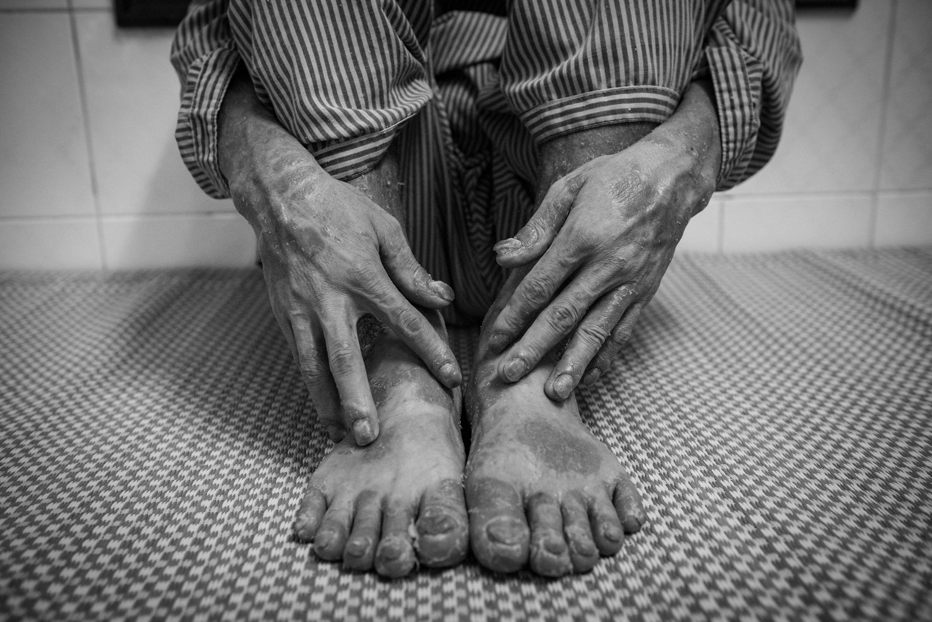 Bệnh nhân vảy nến ảnh 9 Benh nhan vay nen anh 9