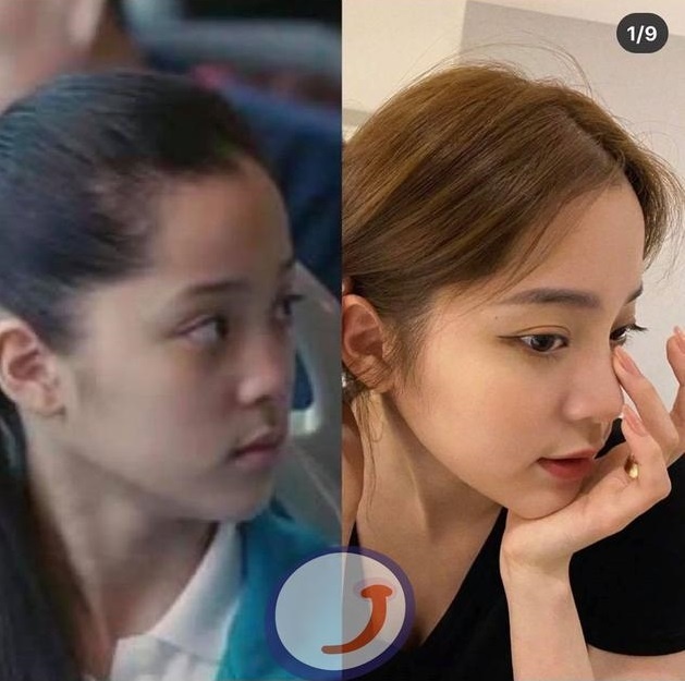 Au Duong Na Na phau thuat tham my anh 1