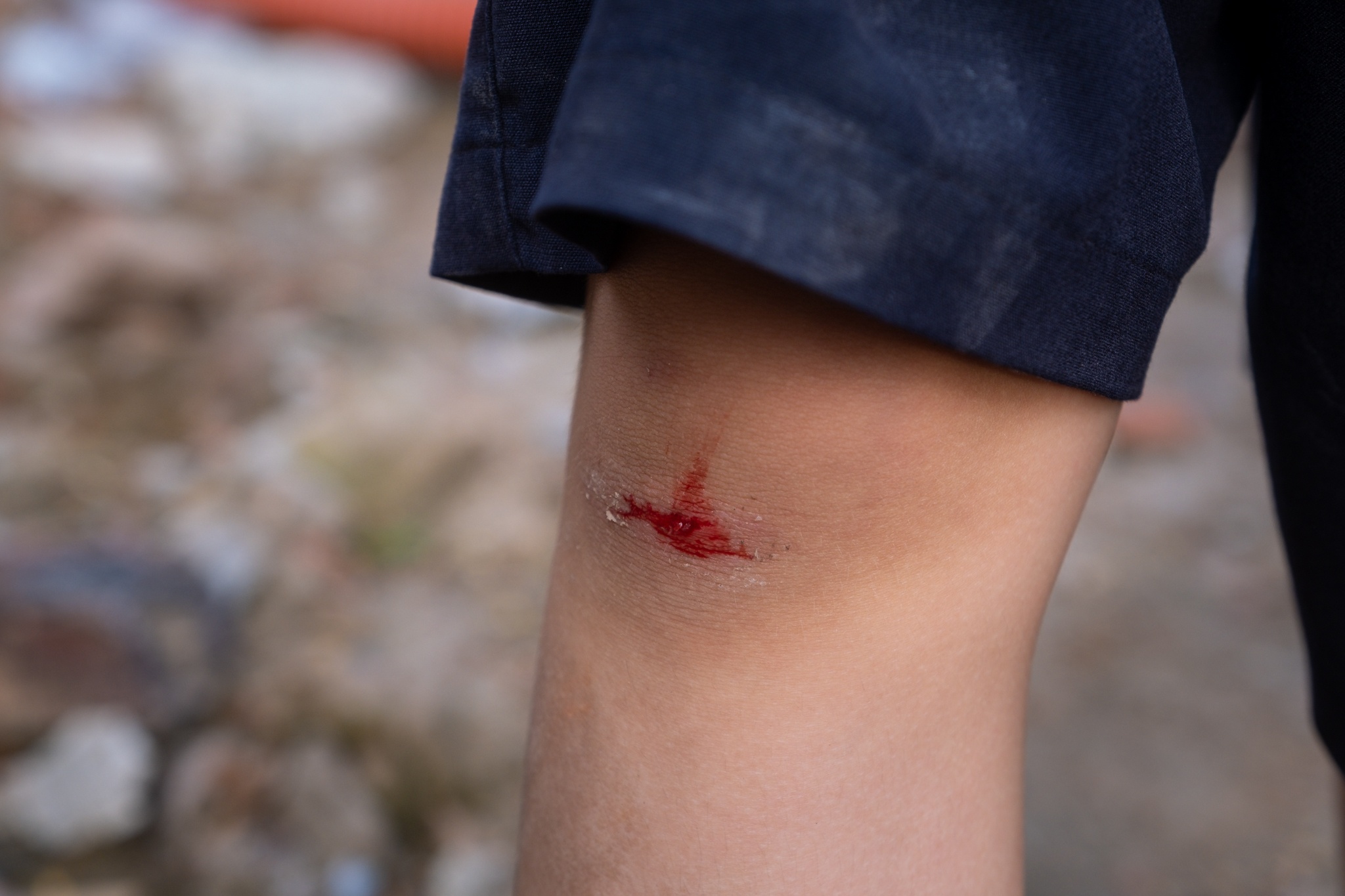 Hoc sinh tieu hoc choi dua tai cong truong dang thi cong anh 6