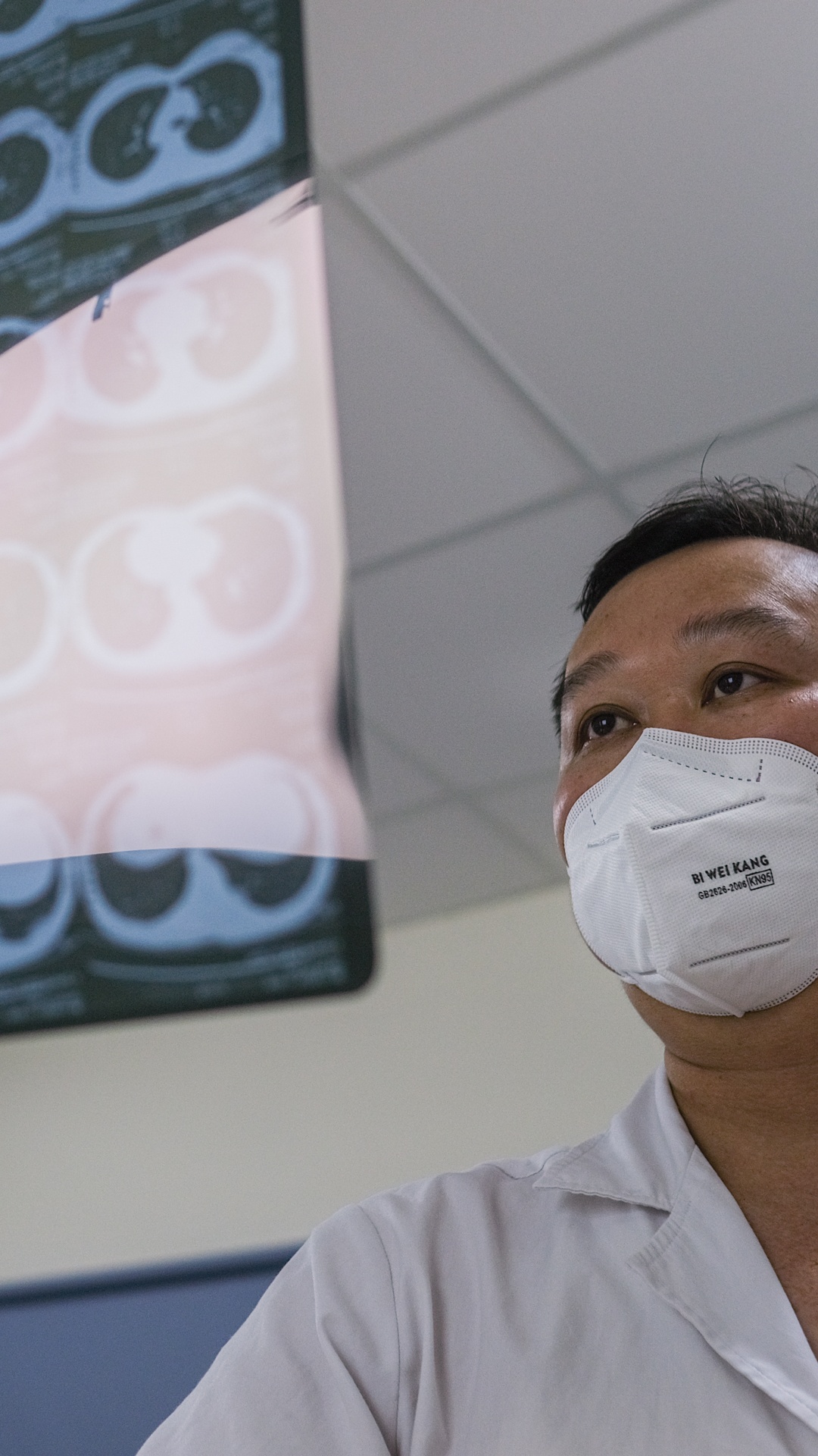 bác sĩ điều trị bệnh nhân Covid-19 ảnh 2 bac si dieu tri benh nhan Covid-19 anh 2