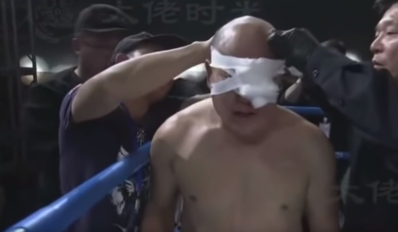 Từ Hiểu Đông đánh bại võ sư kungfu ảnh 1 Tu Hieu Dong danh bai vo su kungfu anh 1