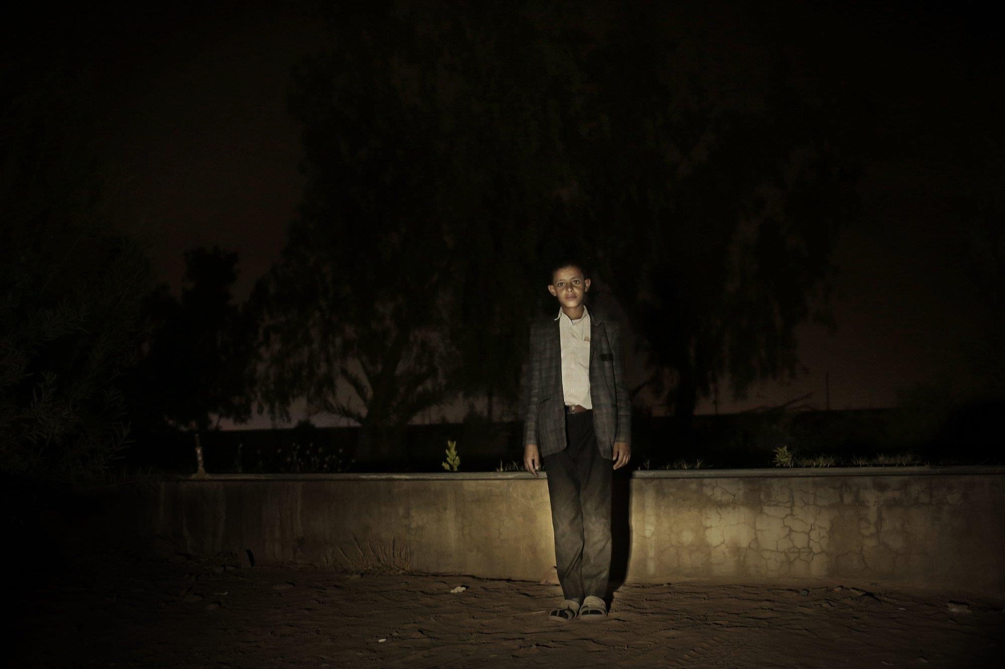 Nhung dua tre phai cam sung trong cuoc chien Yemen anh 4