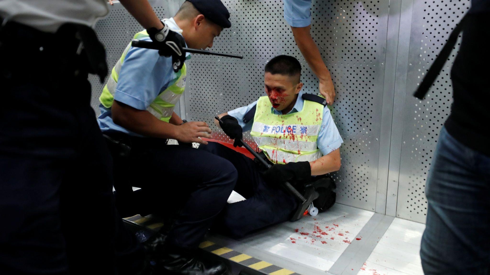 Nguoi bieu tinh dung do canh sat Hong Kong anh 5