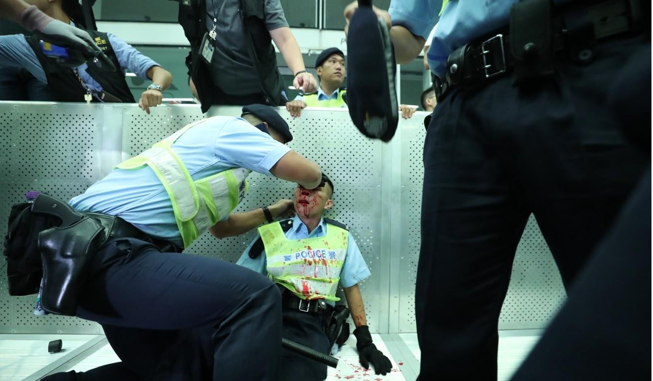 Hong Kong biểu tình ảnh 2 Hong Kong bieu tinh anh 2