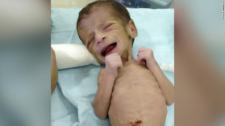 Be gai 4 ngay tuoi duoc cuu sau khi bi chon song o An Do hinh anh