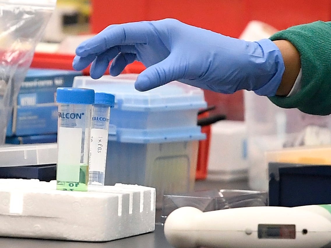 FBI to tin tac TQ danh cap nghien cuu ve Covid-19 cua My hinh anh