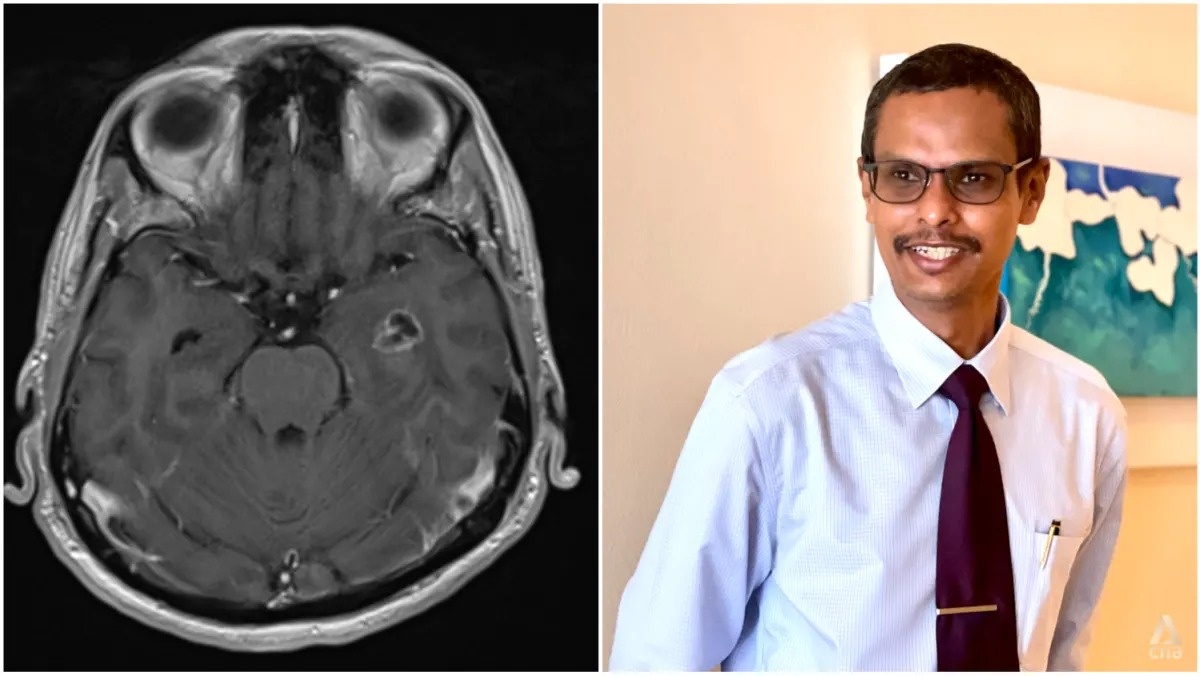 Khoi u nao khien nguoi dan ong thay doi tinh cach hinh anh