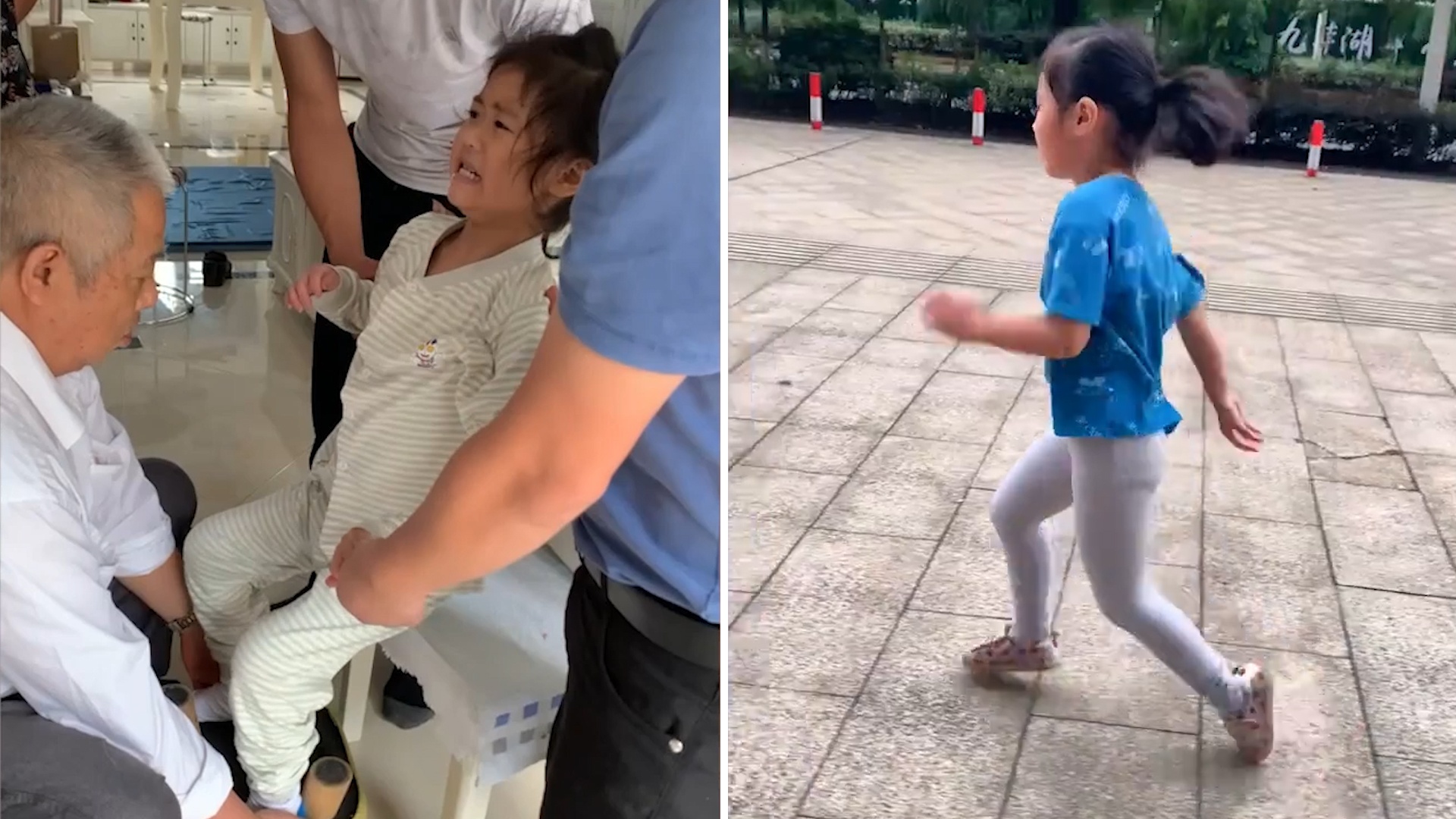 Be 8 tuoi bi liet nua than duoi vi nhay mua hinh anh