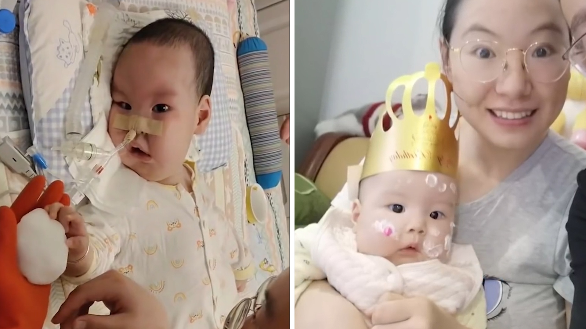 Co be bi teo co tuy song khi moi 3 thang tuoi hinh anh