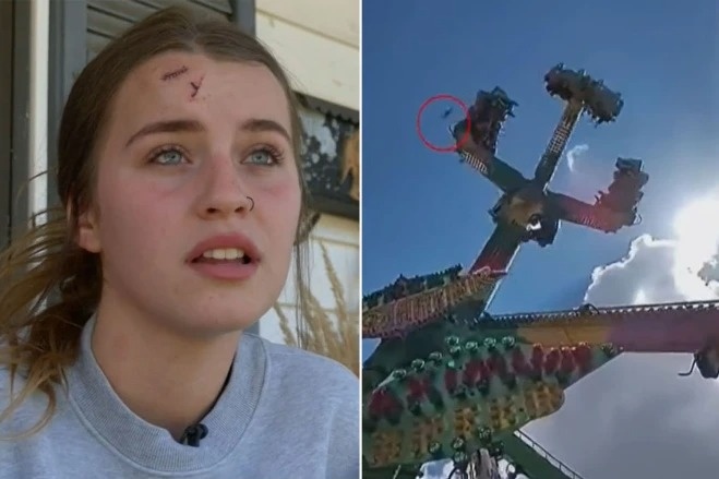 Co gai bi chan thuong nao khi vat la tu tau luon roi trung dau hinh anh