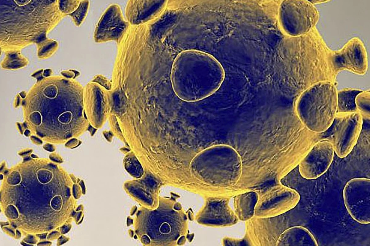 Sieu may tinh TQ va bac si My xung dot ve ket qua chan doan Covid-19 hinh anh