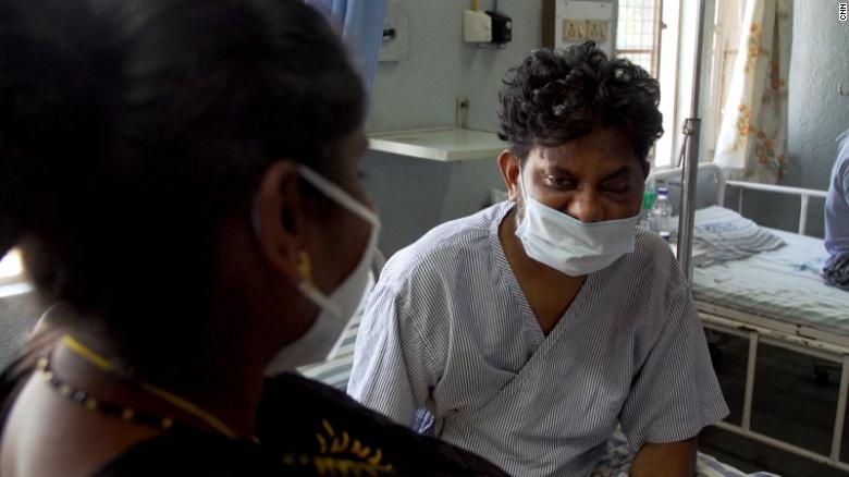 Dich benh nam den o An Do anh 2