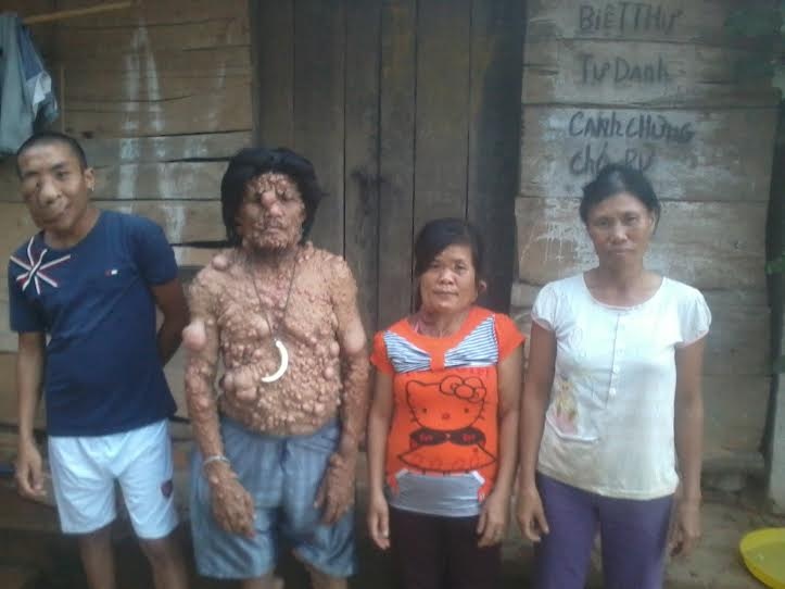 3 cha con mang 'khuon mat quy' hinh anh