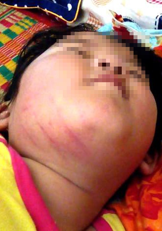 Cô giáo bị tố đánh học sinh ảnh 1 Co giao bi to danh hoc sinh anh 1