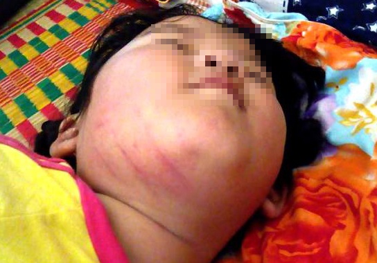 Phu huynh to co giao dung thuoc go danh bam mat tre hinh anh