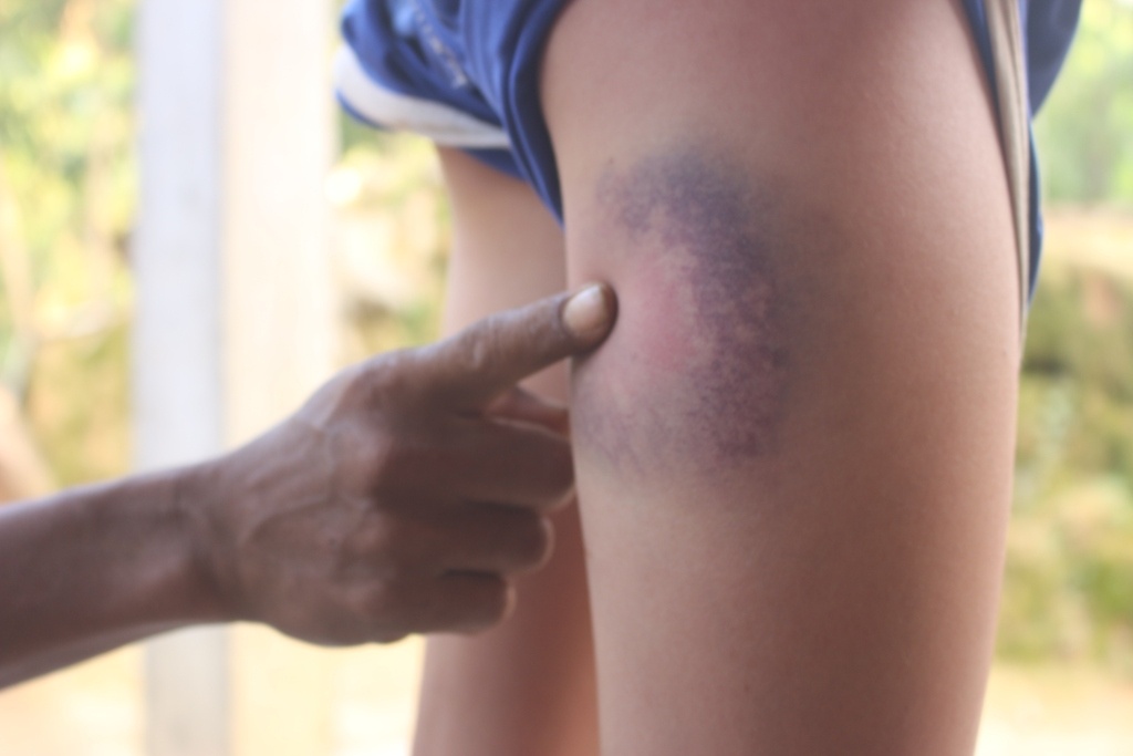 hoc sinh bi thay danh tim dui anh 1