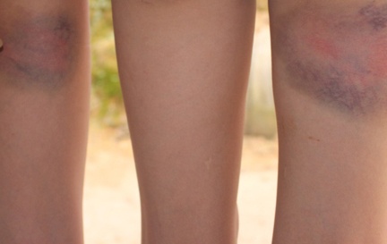 Lam gay ghe, 6 hoc sinh bi thay danh tim dui hinh anh