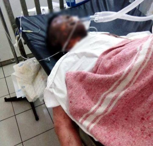 Nam thanh niên bị bỏng ảnh 1 Nam thanh nien bi bong anh 1