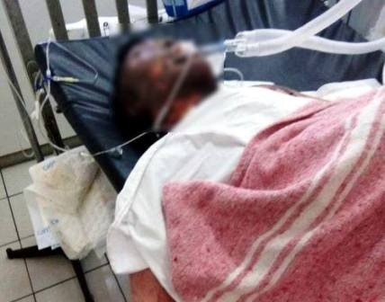 Gia dinh trinh bao cong an viec con trai bi bong bat thuong trong dem hinh anh