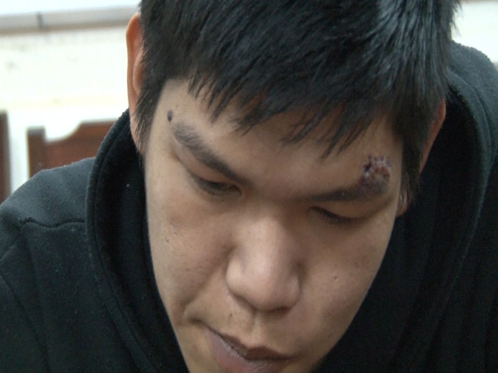 Ngan chan trom anh 1