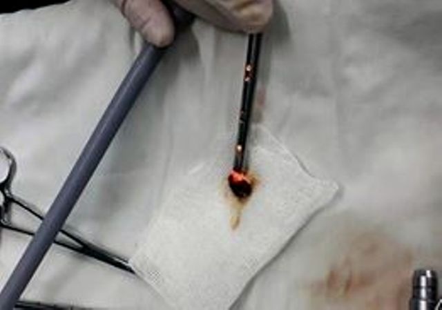 Chau be bi hoc hat dua o co anh 2