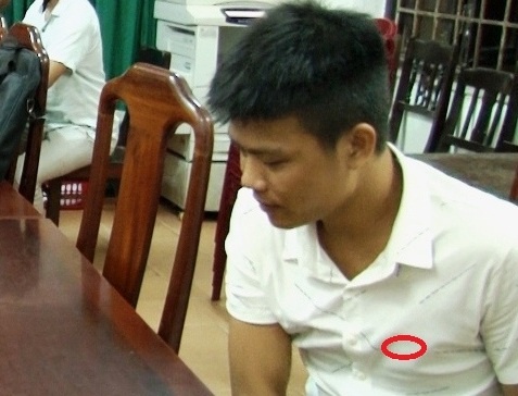 Ke gian bi tom khi quay lai bai gui lay xe di ban hinh anh