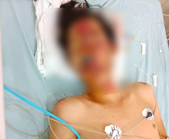 Cong an ruot duoi gay tai nan anh 1