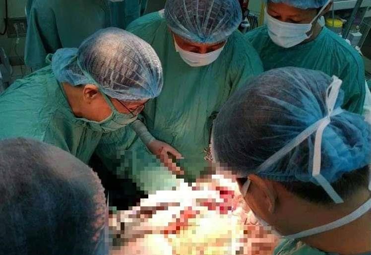 Phẫu thuật ung thư gan ảnh 1 Phau thuat ung thu gan anh 1