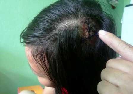 Nu tai xe taxi bi bao ve benh vien danh vo dau hinh anh